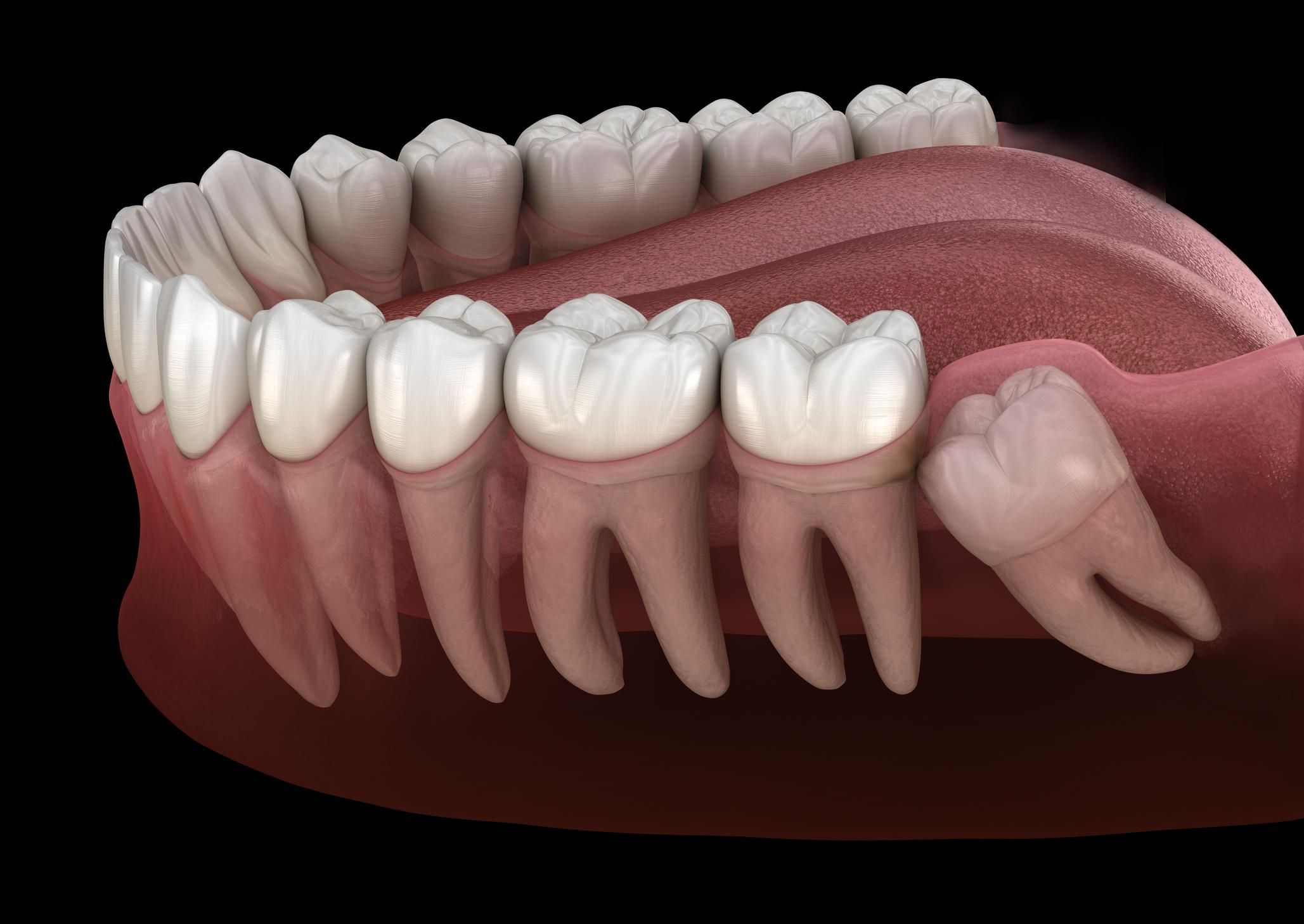 Зникають зуби мудрості і з'являється додаткова артерія: вчені виявили нову стадію еволюції