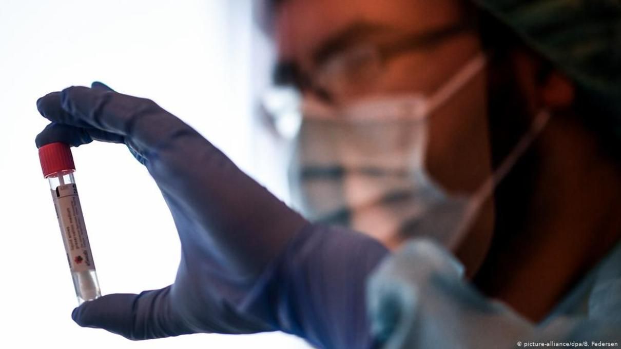 У Нідерландах померла перша в світі людина від повторного зараження COVID-19 У Нідерландах померла перша в світі людина від повторного зараження COVID-19