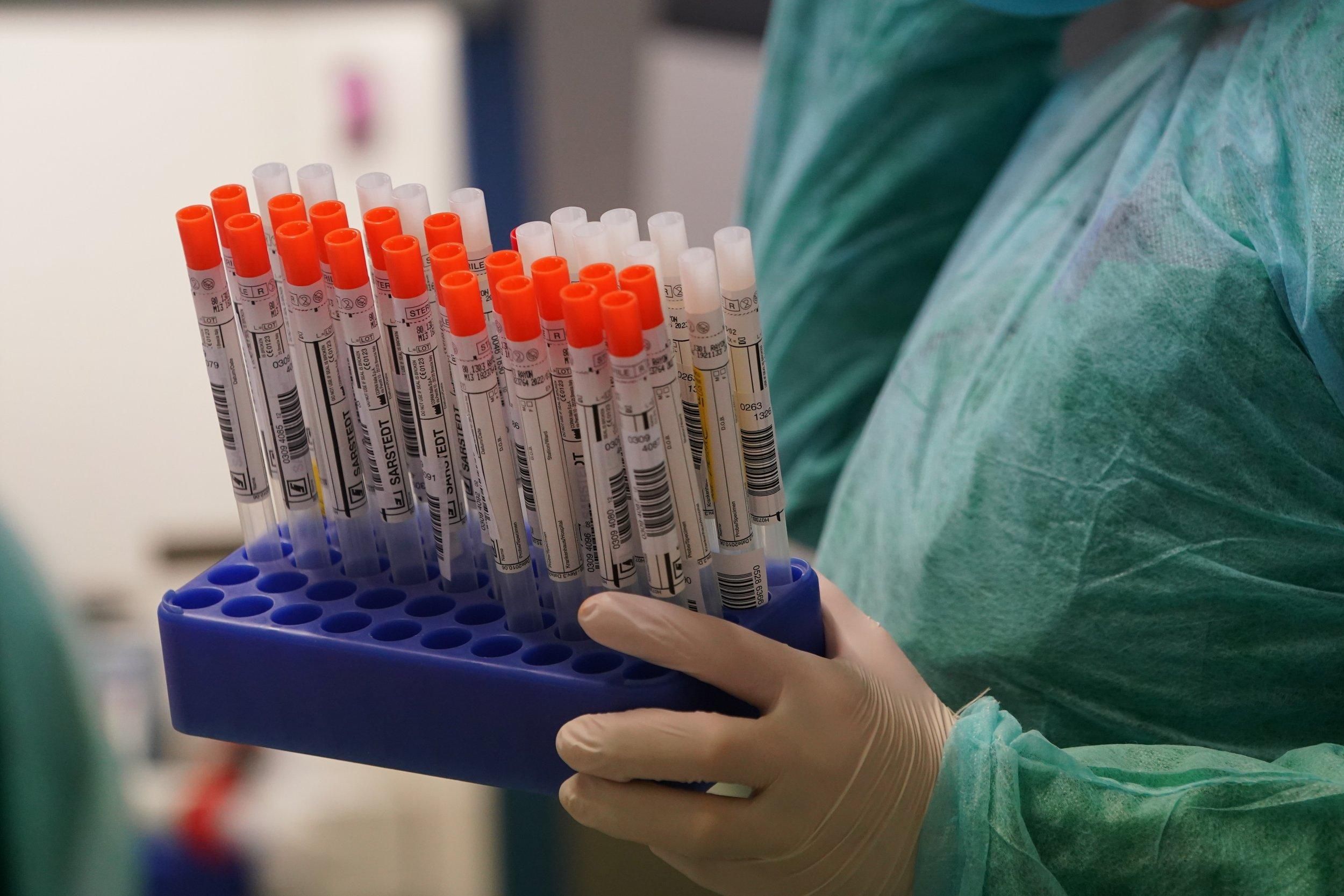 Уряд змусив МОЗ збільшити кількість тестувань на коронавірус
