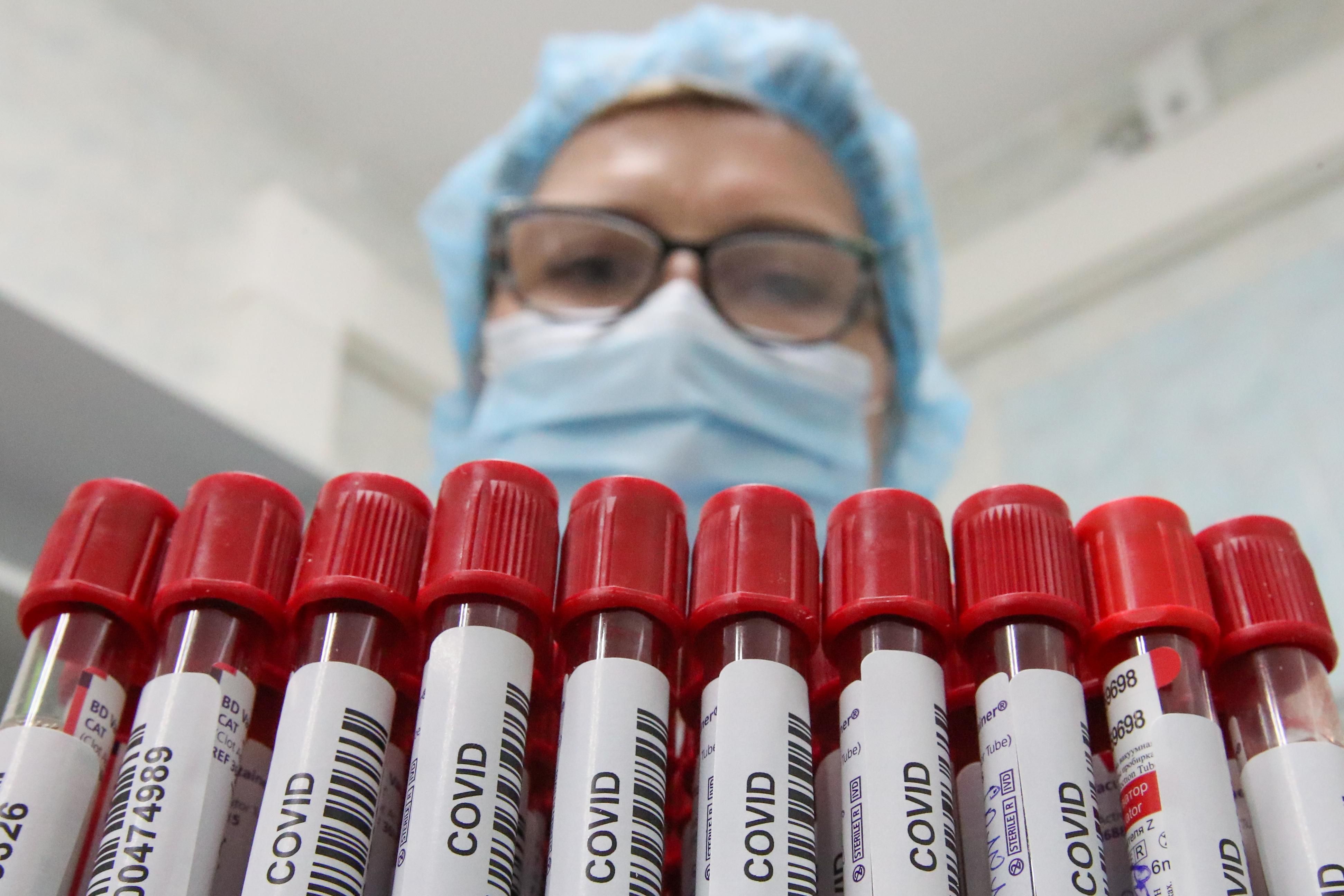 Лечение антителами могло спасти тысячи украинцев, – ученый о COVID-19