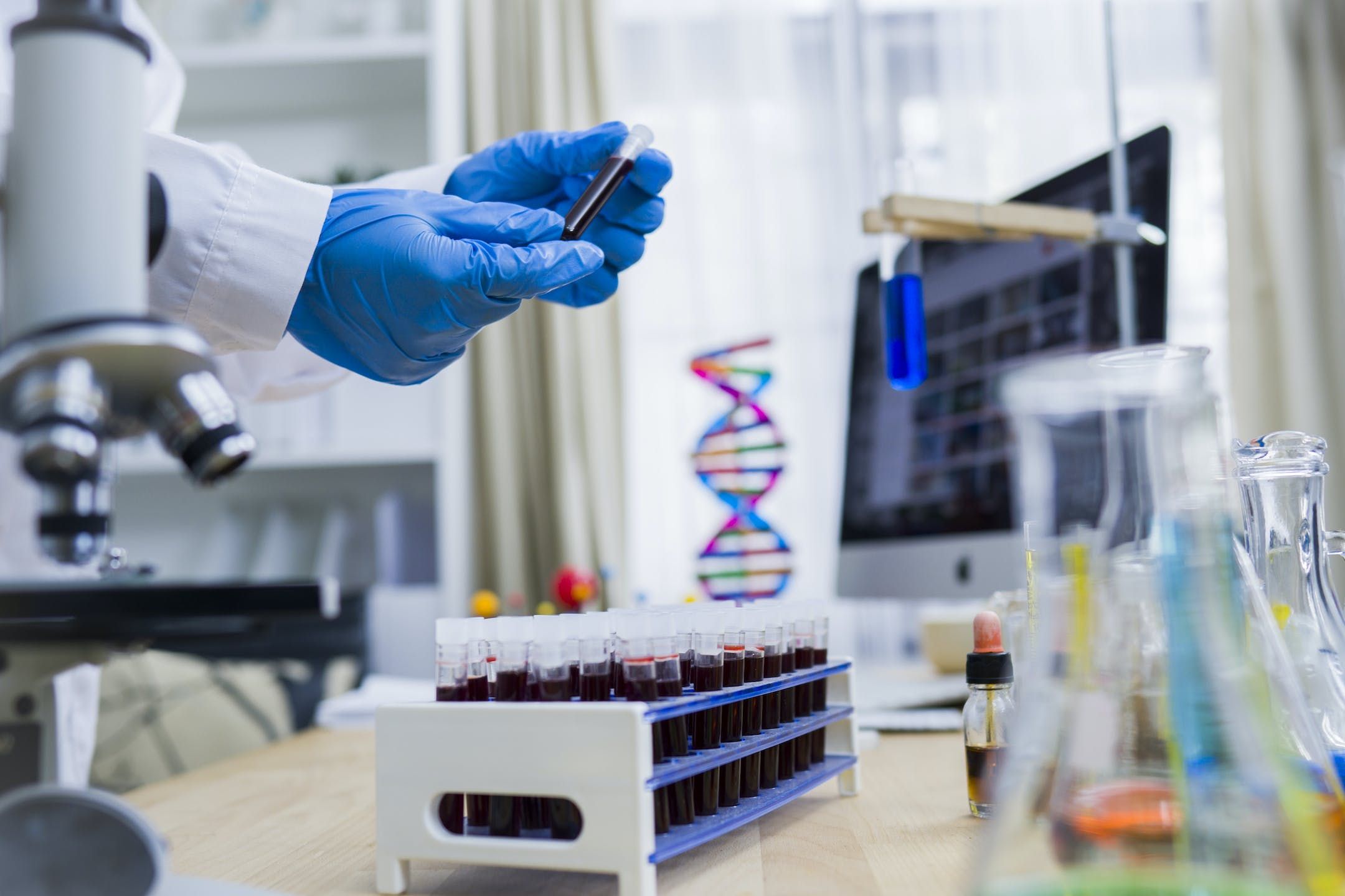 Тяжесть течения коронавируса определяет группа крови пациента: каким образом Тяжесть течения коронавируса определяет группа крови пациента: каким образом