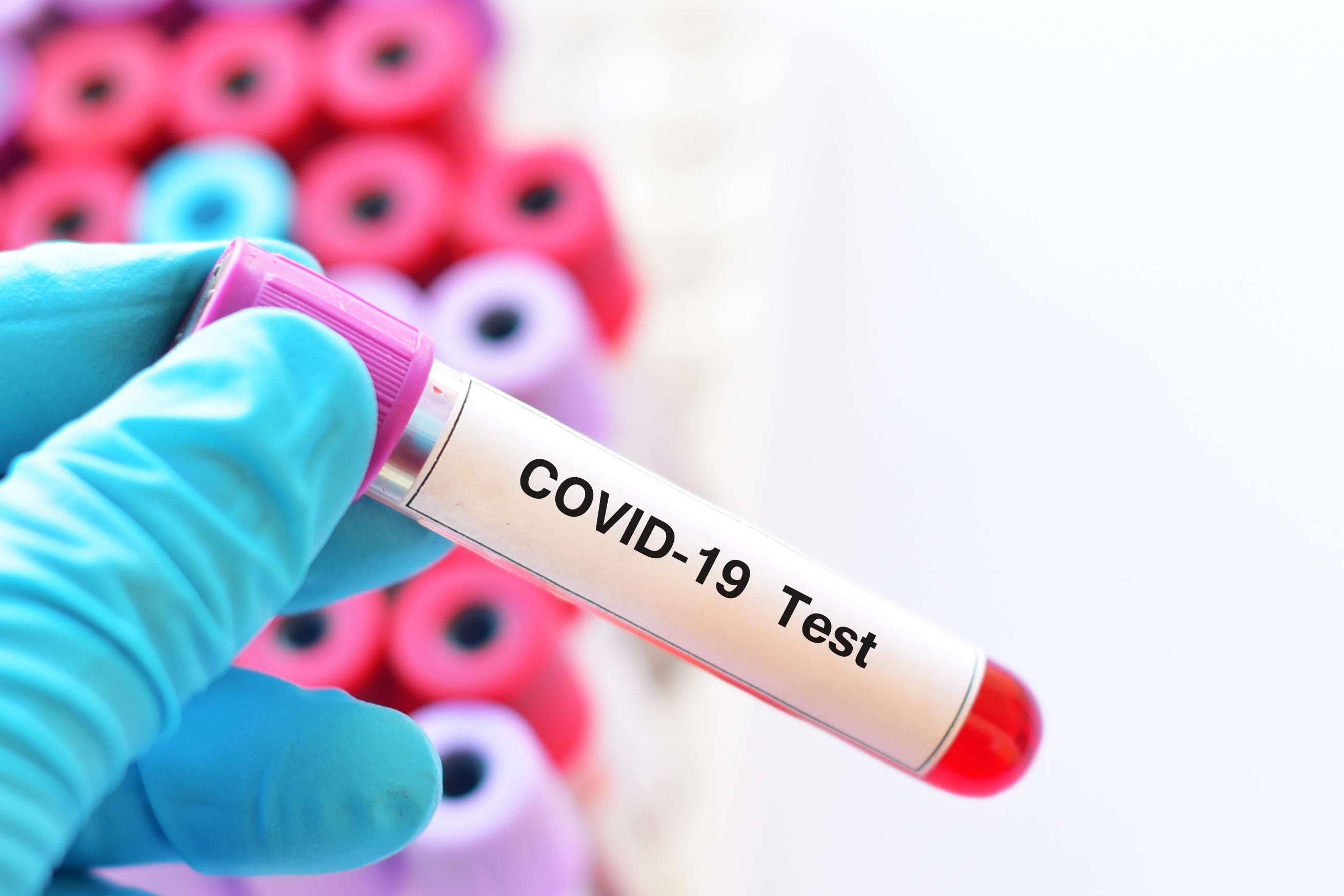 Министр здравоохранения Германии заразился COVID-19 Министр здравоохранения Германии заразился COVID-19