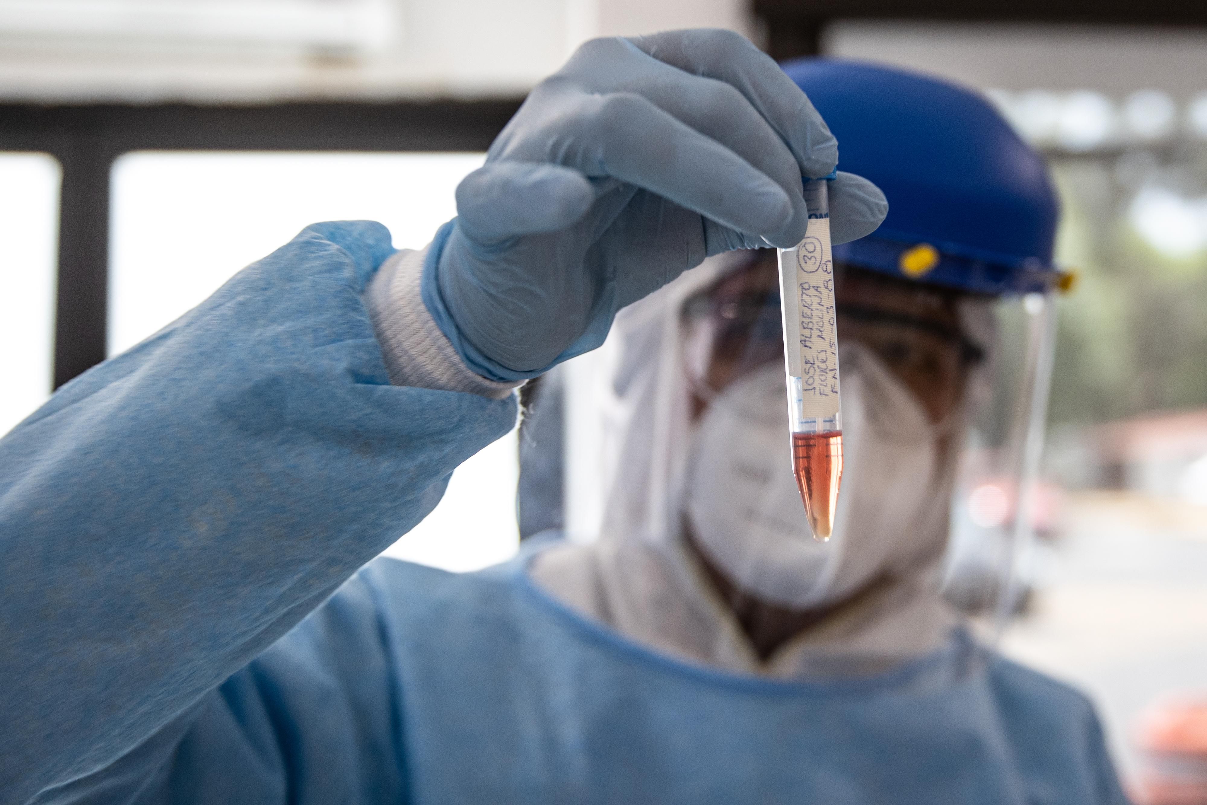 Коли з'явиться українська вакцина від коронавірусу Коли з'явиться українська вакцина від коронавірусу