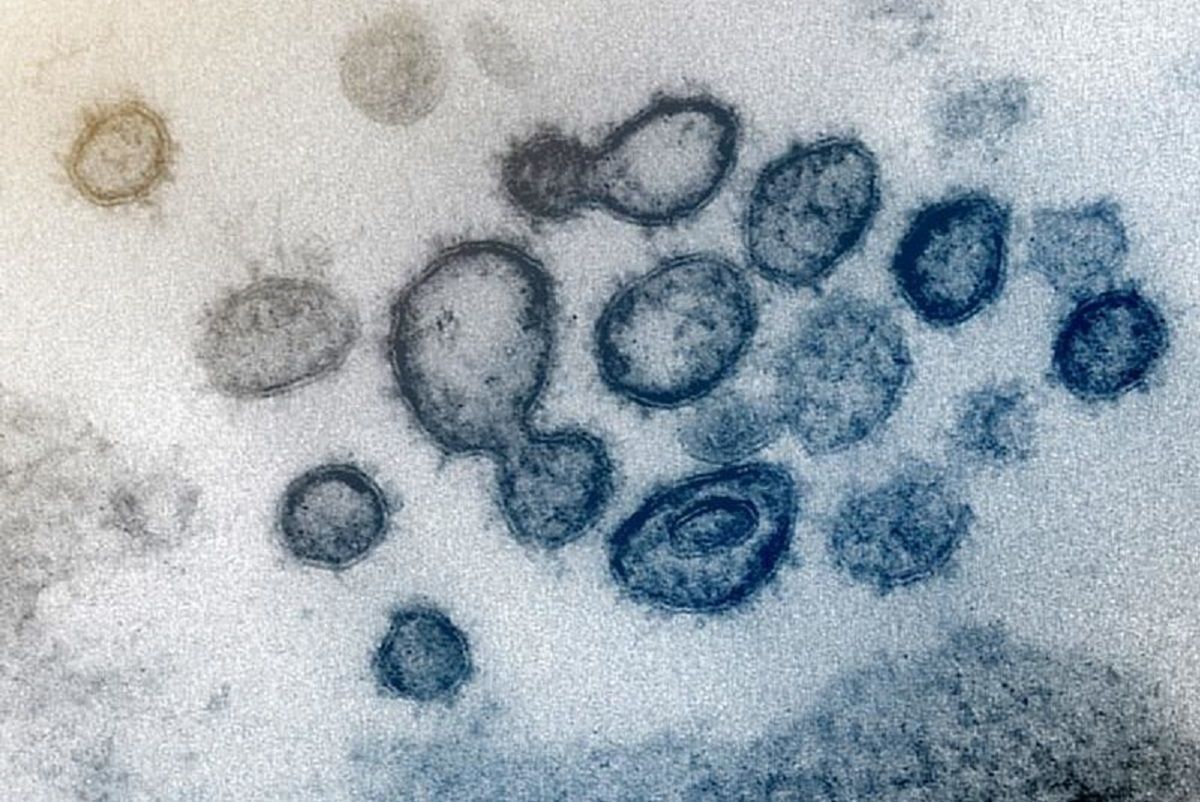 Чому коронавірус може перебігати безсимптомно