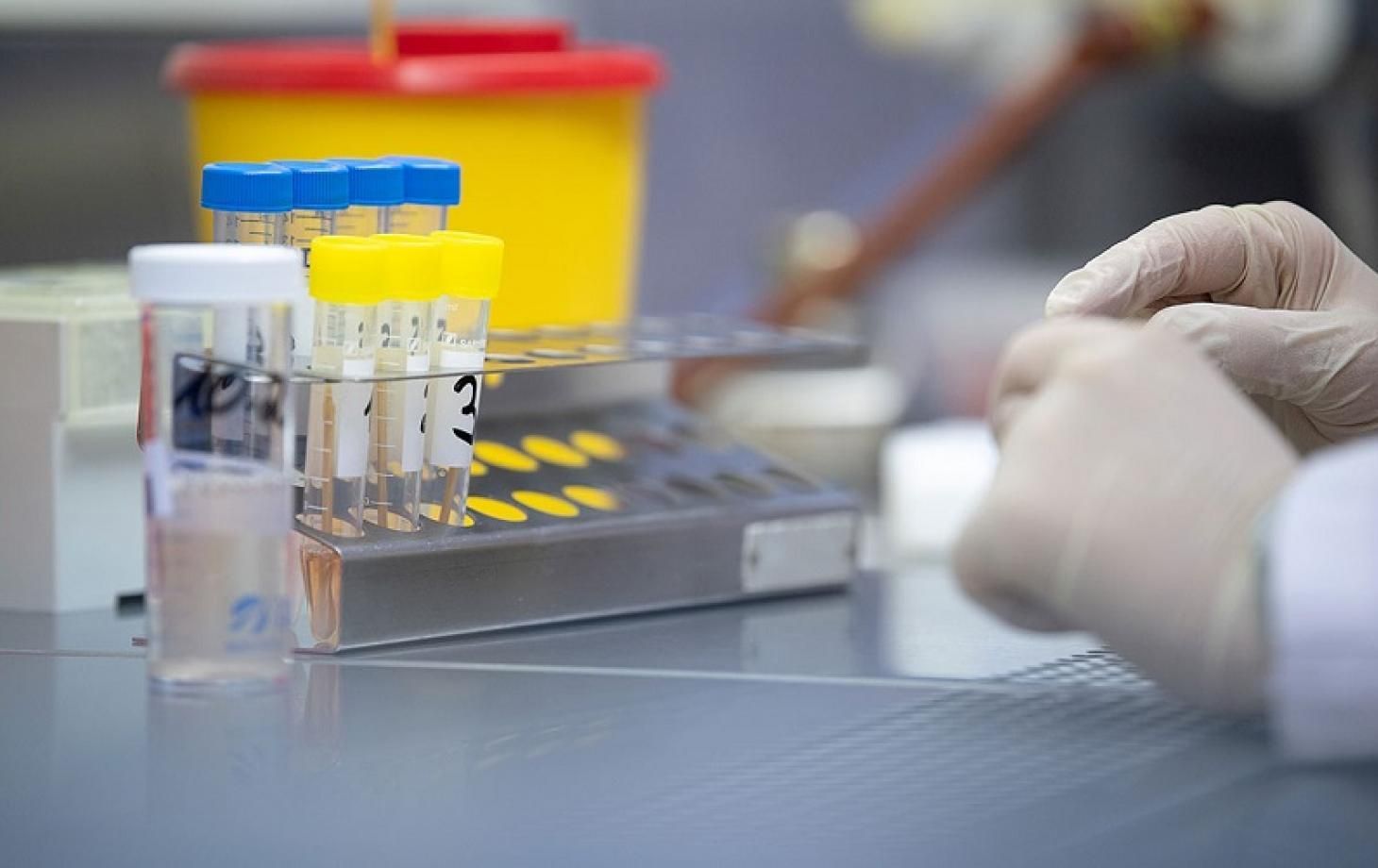 Українці стали менше тестуватися на COVID-19: дані МОЗ Українці стали менше тестуватися на COVID-19: дані МОЗ