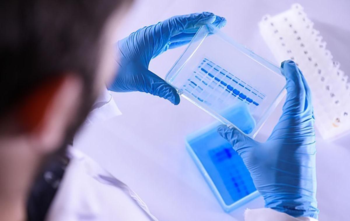 У Конго могла з'явитися нова смертельна хвороба: що про неї відомо У Конго могла з'явитися нова смертельна хвороба: що про неї відомо