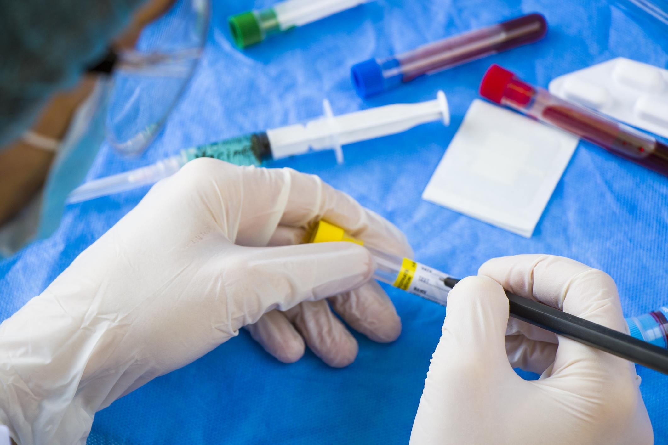 Перший випадок мутованого COVID-19 вже зафіксували у Грузії Перший випадок мутованого COVID-19 вже зафіксували у Грузії