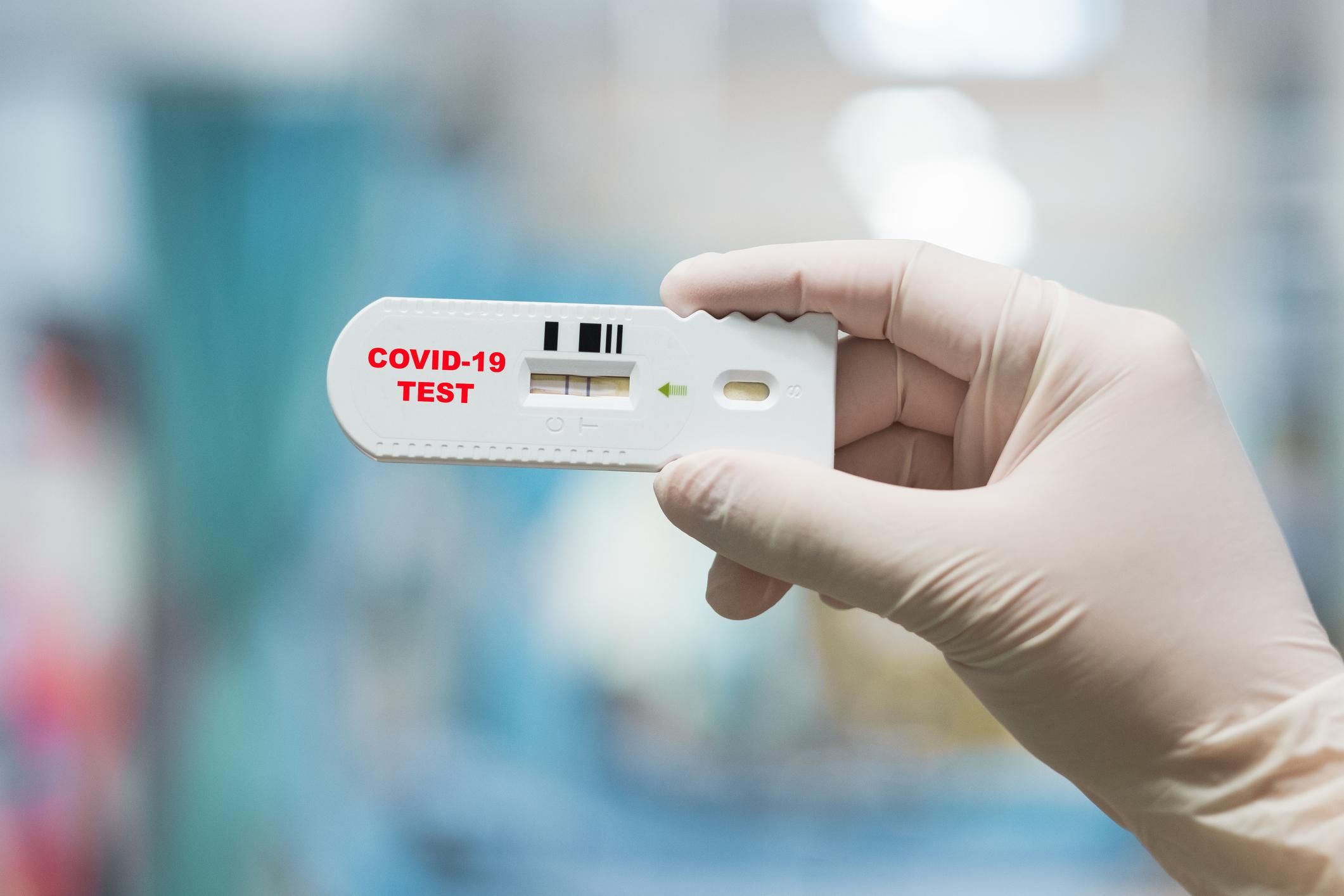 Новий штам коронавірусу може давати помилково негативний результат тесту