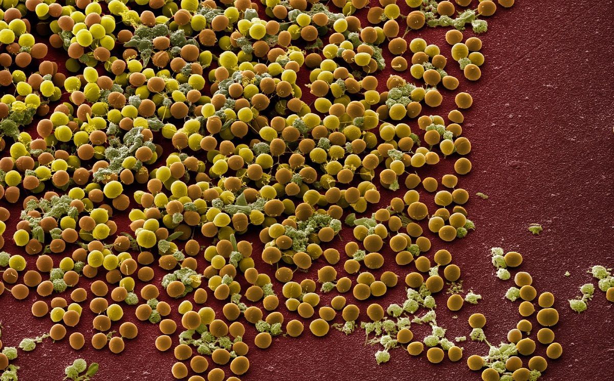 ГМО-бактерии произведут в 10 раз больше антибиотика против стафилококка
