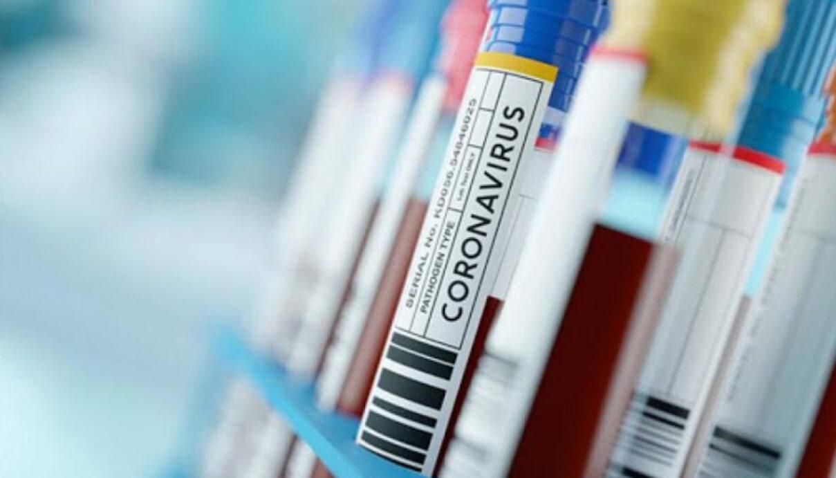 Статистика захворювання на коронавірус у лавах ЗСУ за 15.01.2021 Статистика захворювання на коронавірус у лавах ЗСУ за 15.01.2021