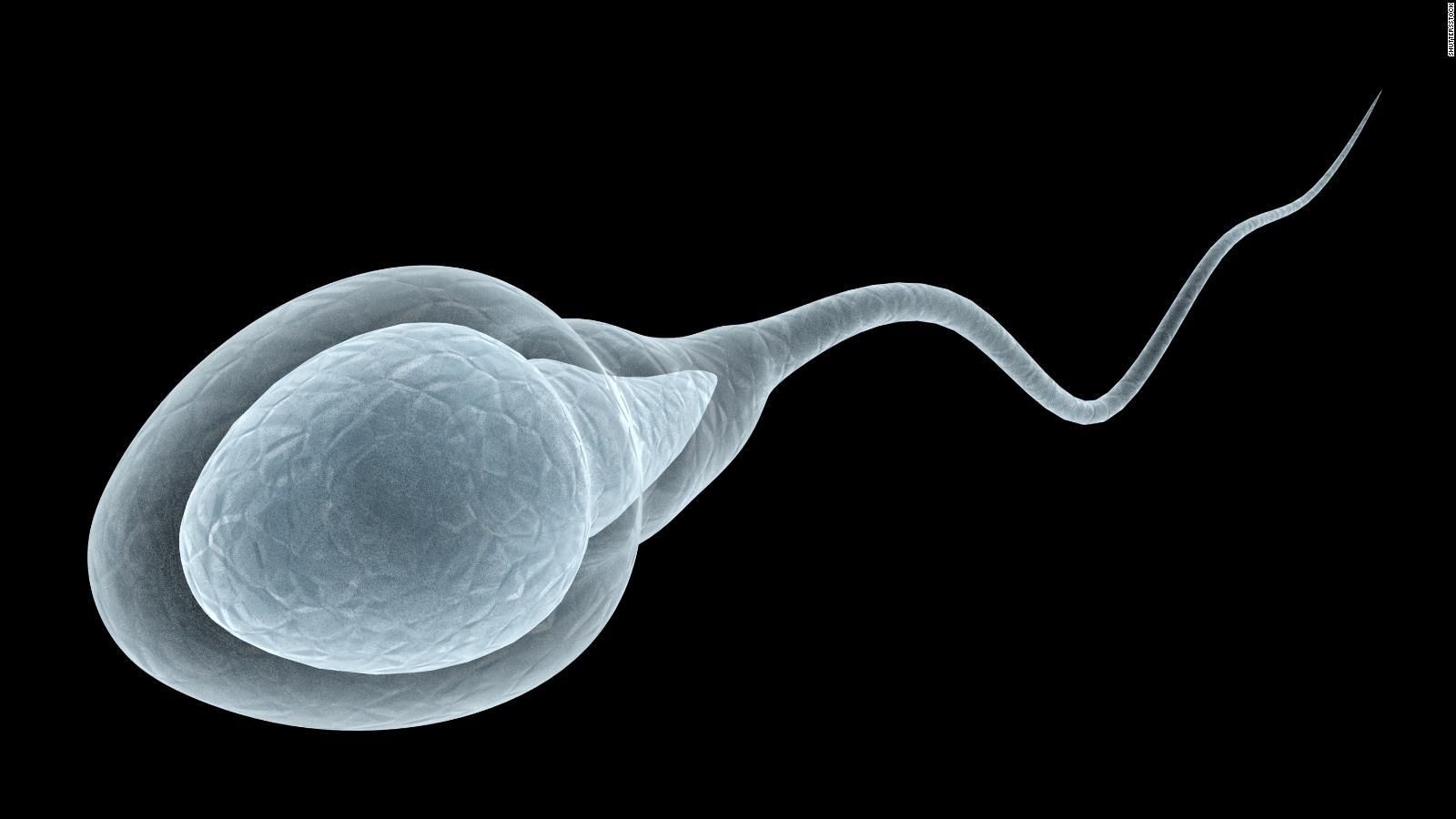 Коронавирус существенно ухудшает качество спермы, – исследование
