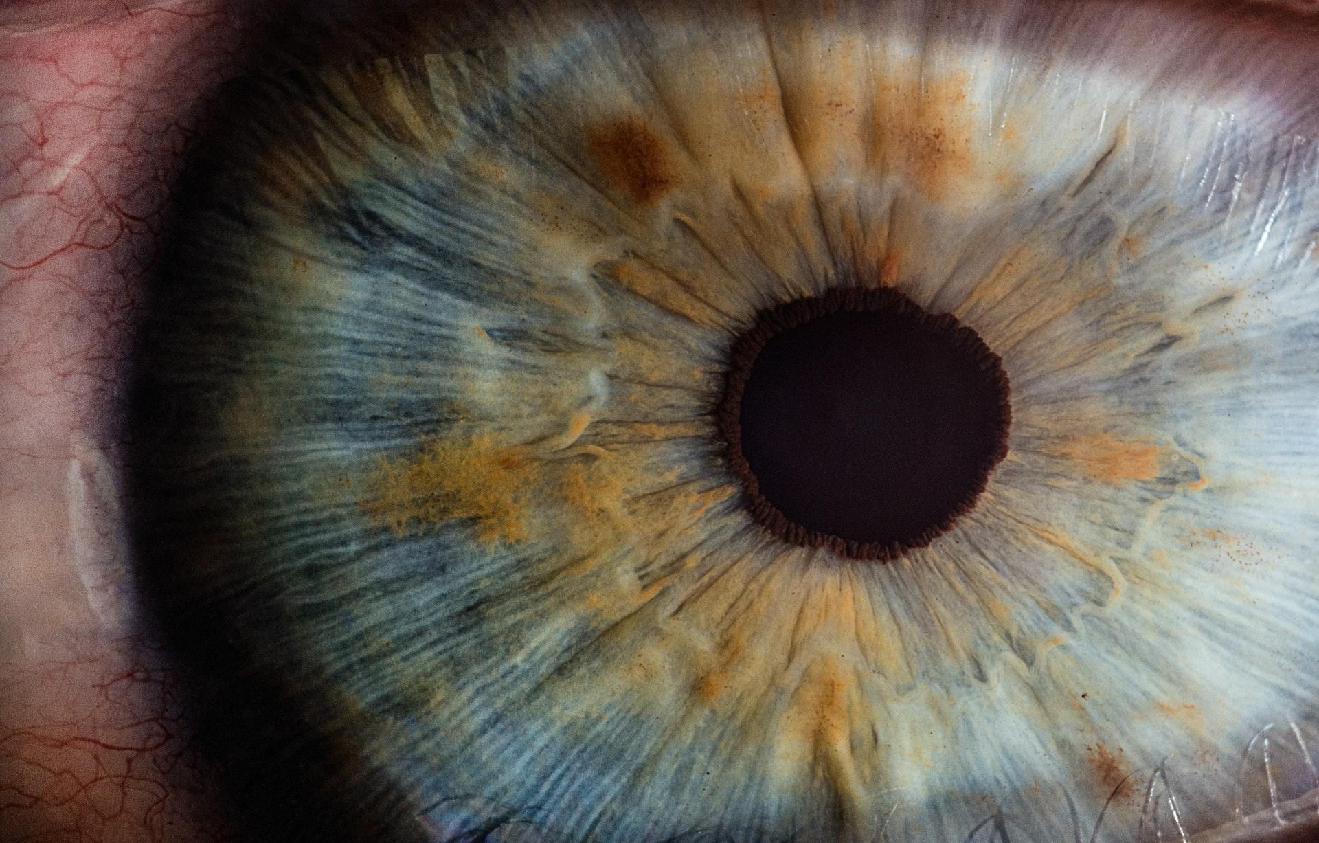 Коронавирус может повредить глаза: новое исследование
