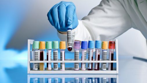 В Україні створили тест, який може перевірити ефективність будь-якої COVID-вакцини