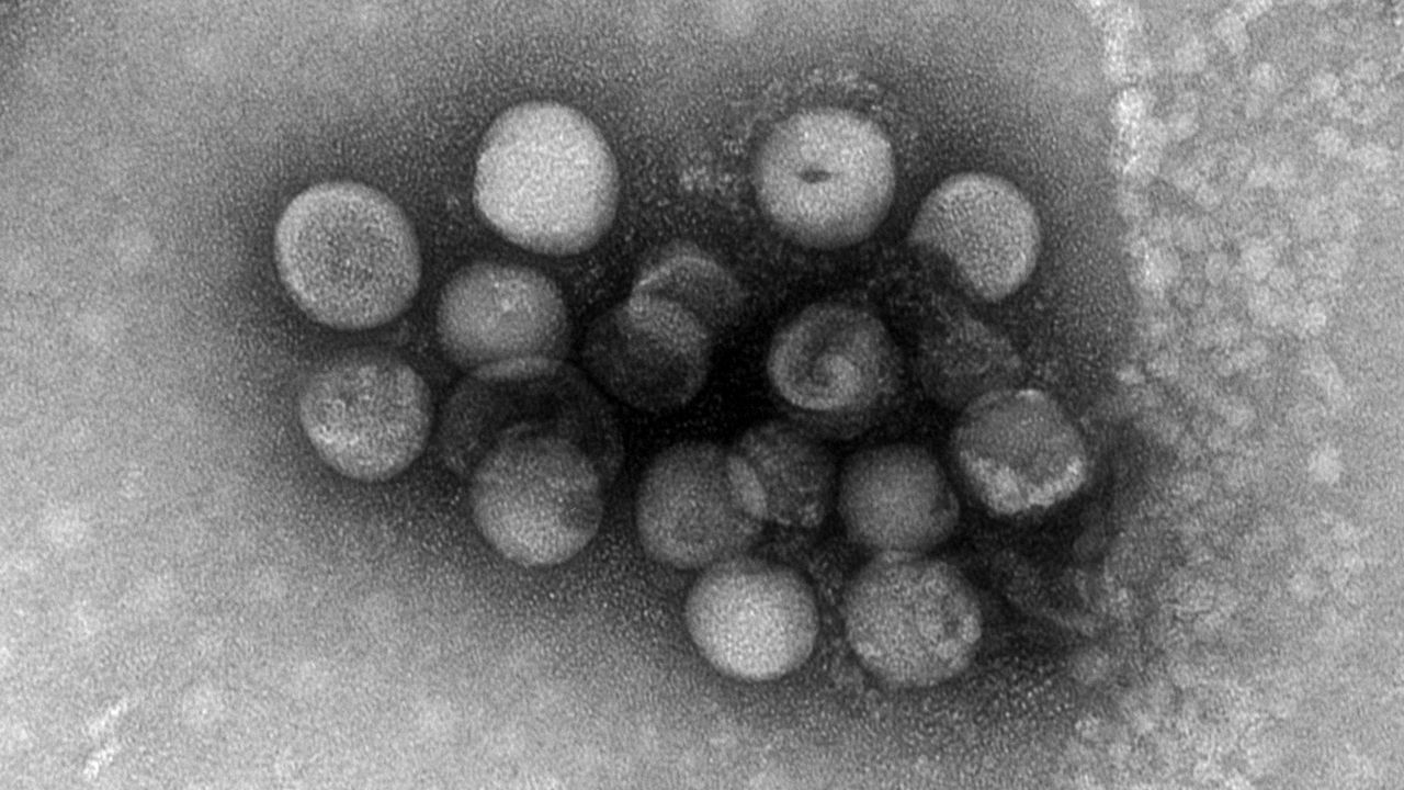 Знайшли ще 2 коронавіруси, які тварини можуть передати людям