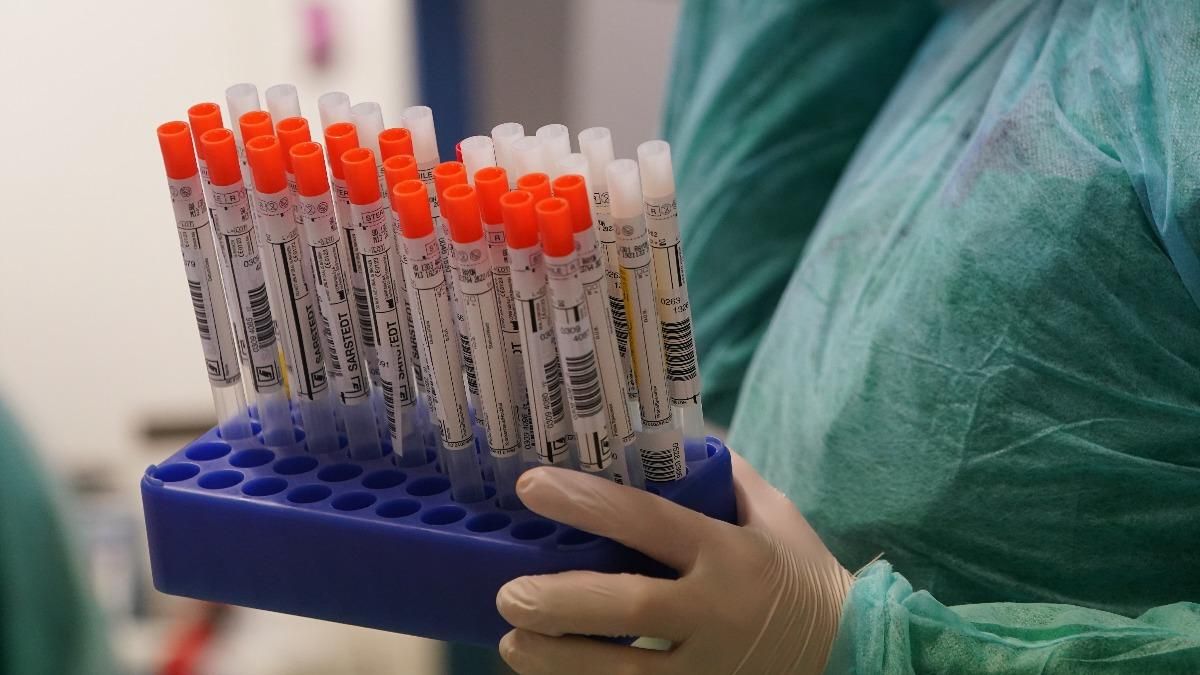 За сутки в Украине 1785 человек заболели коронавирус За сутки в Украине 1785 человек заболели коронавирус