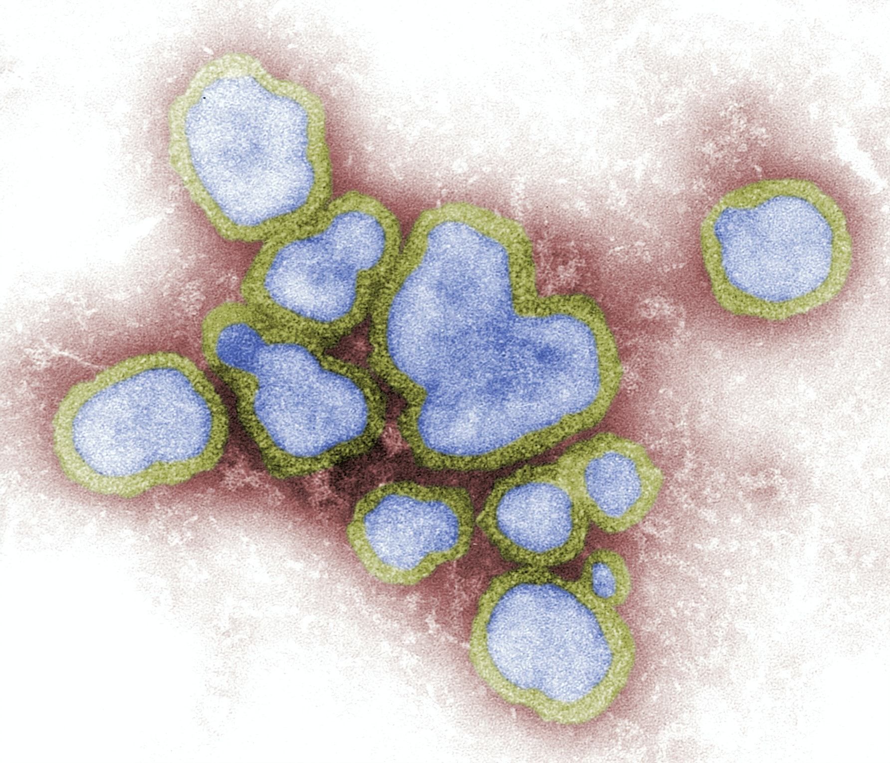 Лютував 20 тисяч років тому: вчені вважають, це не перша пандемія коронавірусу