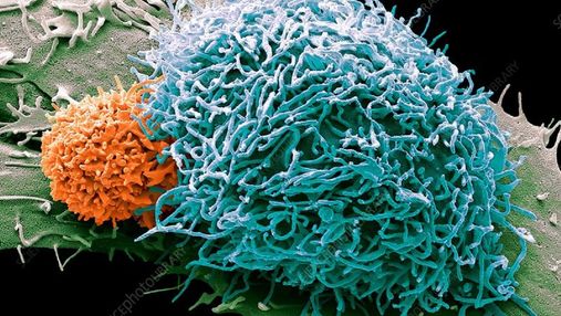 Неожиданное открытие: раковые клетки съедают сами себя, чтобы выжить