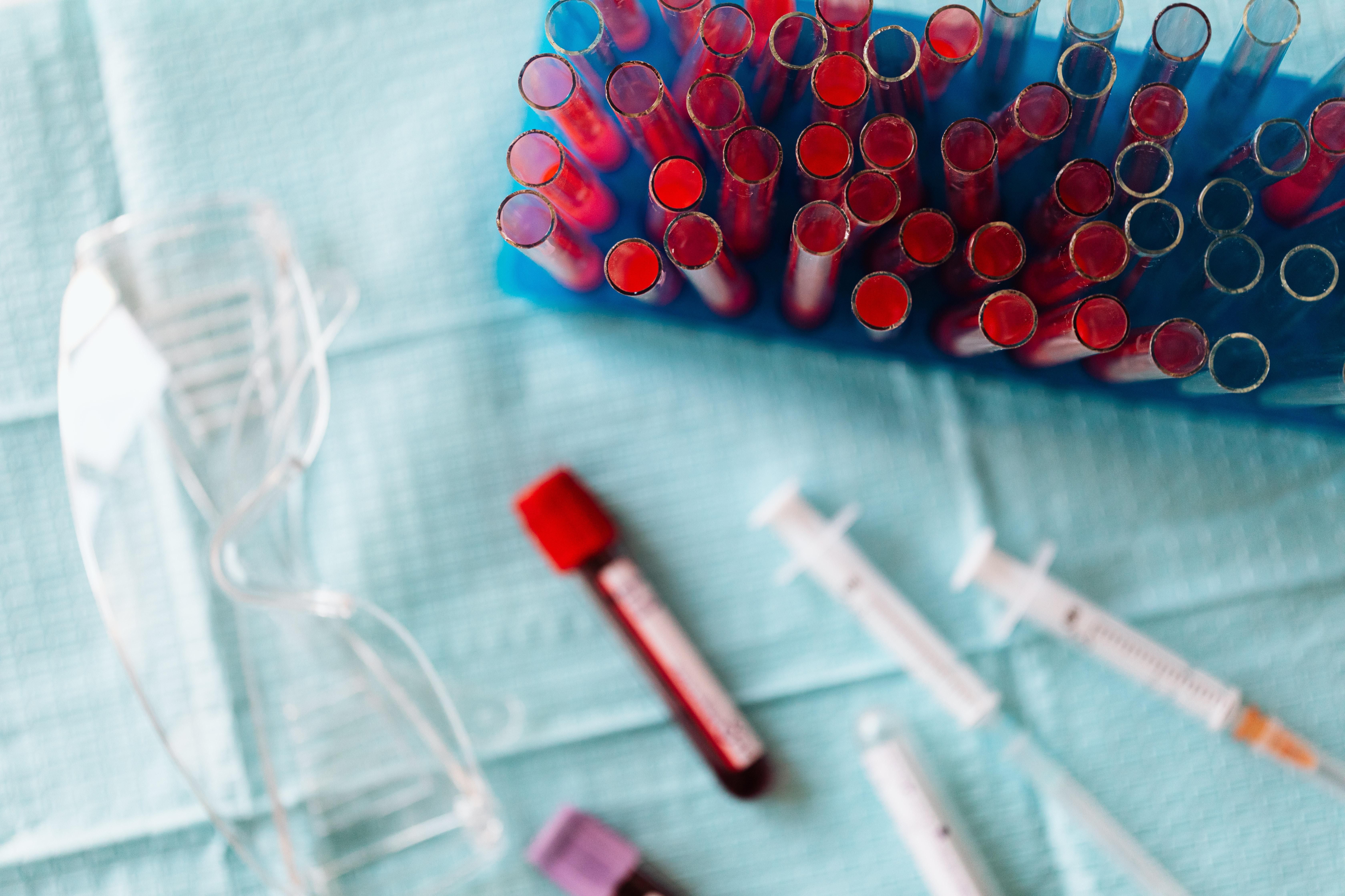 Есть ли смысл делать тест на антитела, если вы вакцинированы: в НСЗУ дали четкий ответ