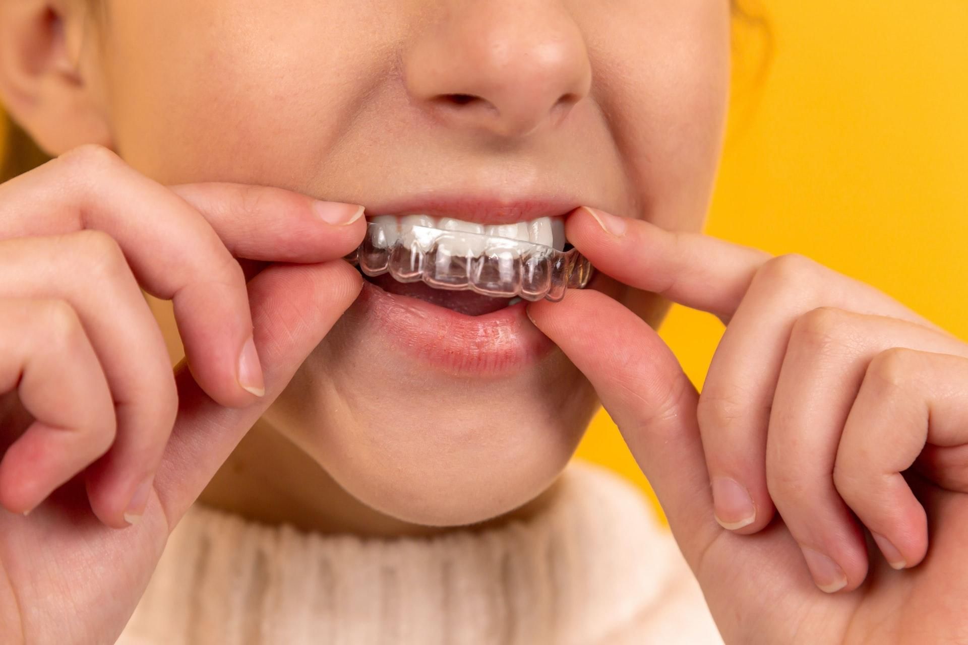 Як відбілювання впливає на здоров'я зубів: нове дослідження - Новини Здоров’я