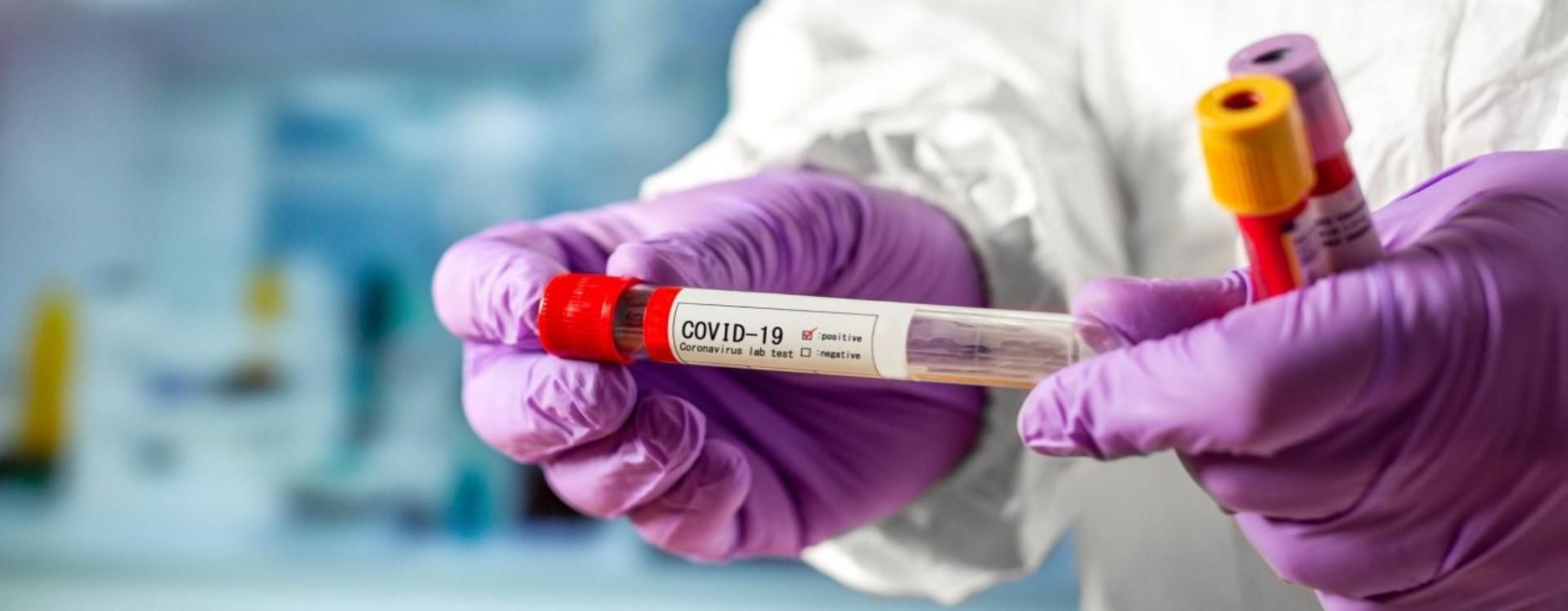 Захворюваність на COVID-19 в Україні висока навіть після вихідних - Гарячі новини - Новини Здоров’я