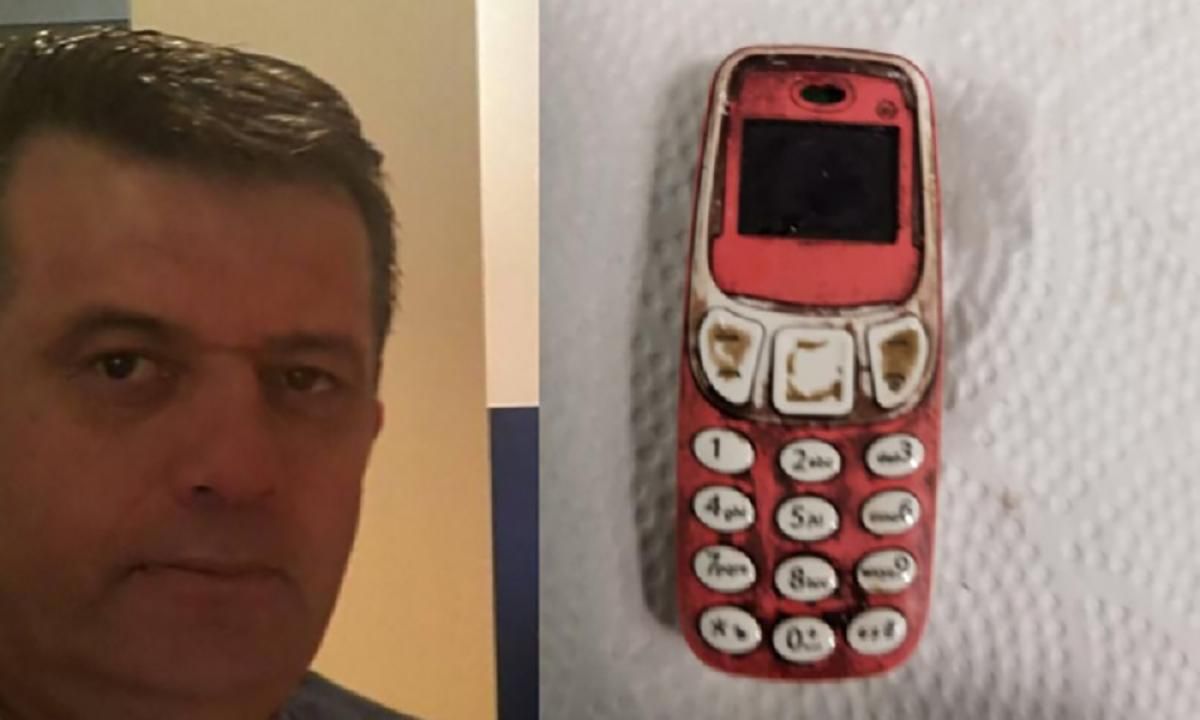 Чоловік у Косово проковтнув телефон: як лікарі його рятували – несподівані фото - Новини Здоров’я