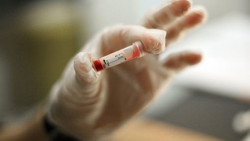 Скільки в Україні виявили хворих на ВІЛ та туберкульоз за серпень 2021 року