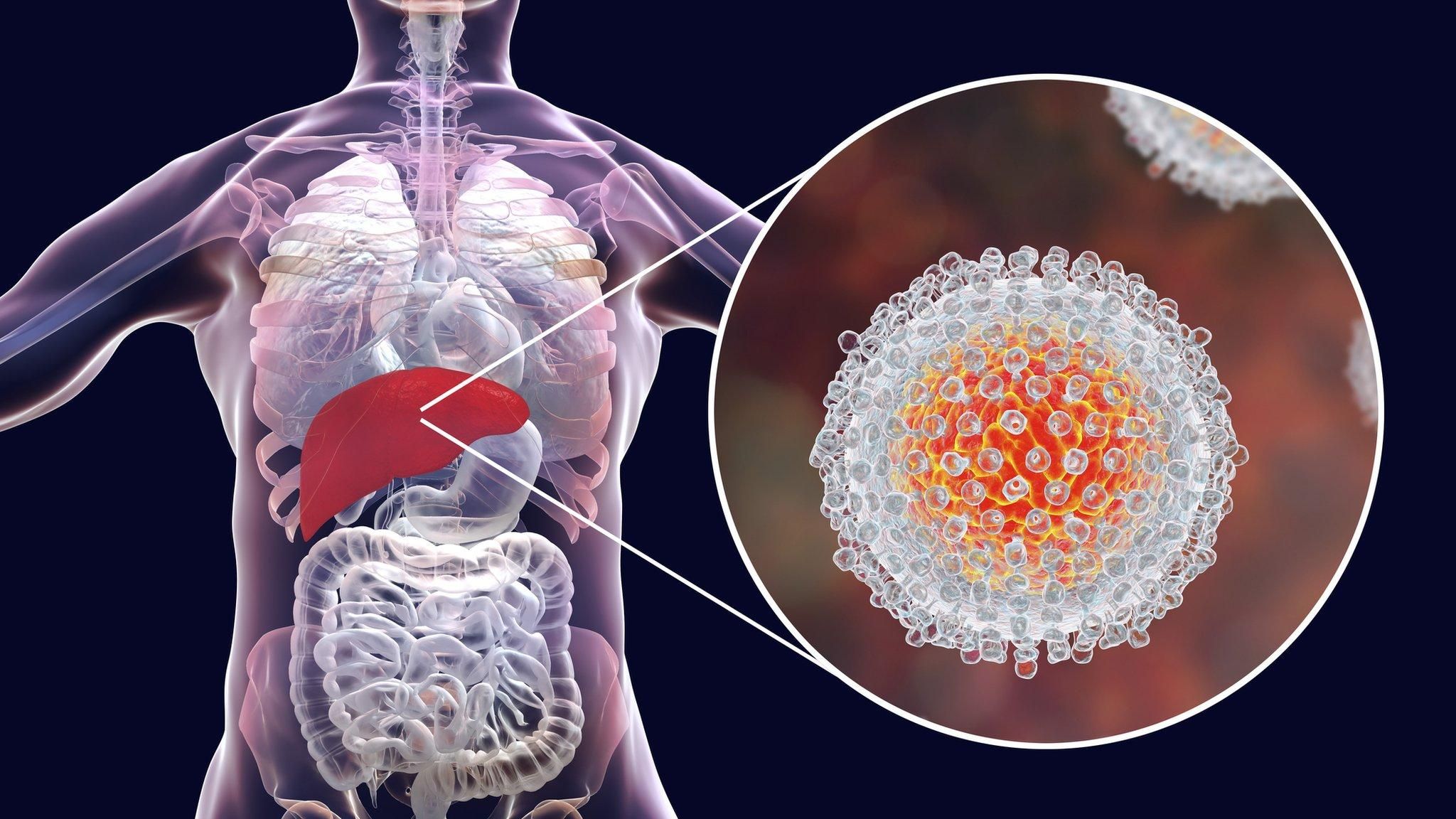 Как вирус гепатита C проникает в клетки: ученые стали на шаг ближе к разработке вакцины