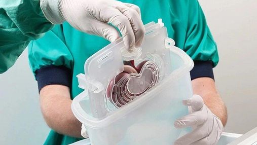 Тарифи на трансплантацію серця та легень збільшили втричі