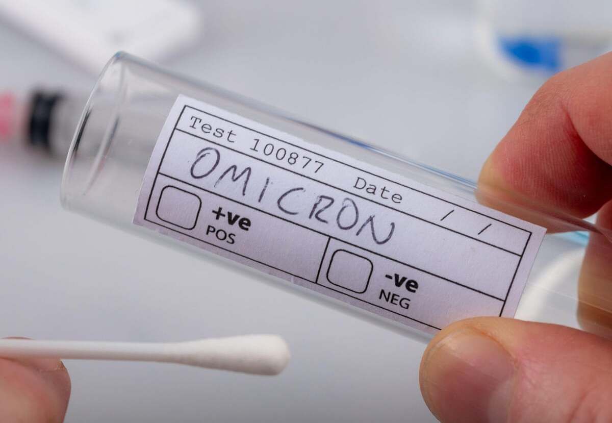 Пока неизвестно, опасней ли Омикрон, чем другие штаммы COVID-19, – ВОЗ Пока неизвестно, опасней ли Омикрон, чем другие штаммы COVID-19, – ВОЗ