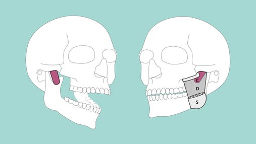 На челюсти человека обнаружили новый мышечный слой