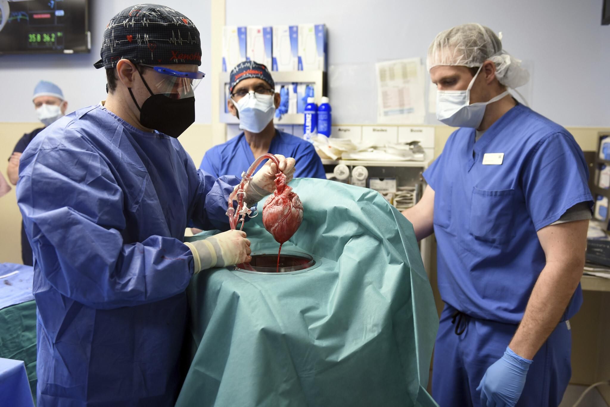 Хирурги в США впервые пересадили человеку сердце свиньи: видео экспериментальной операции