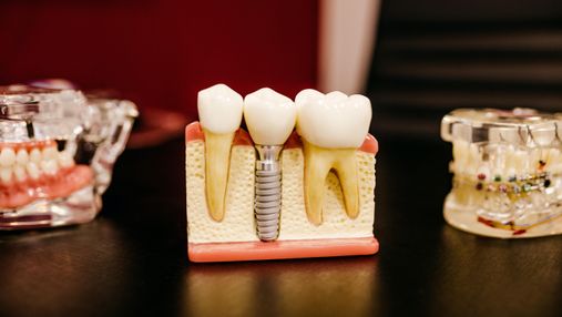 Як втрата зубів пов'язана з деменцією: дослідження з поясненням лікаря 