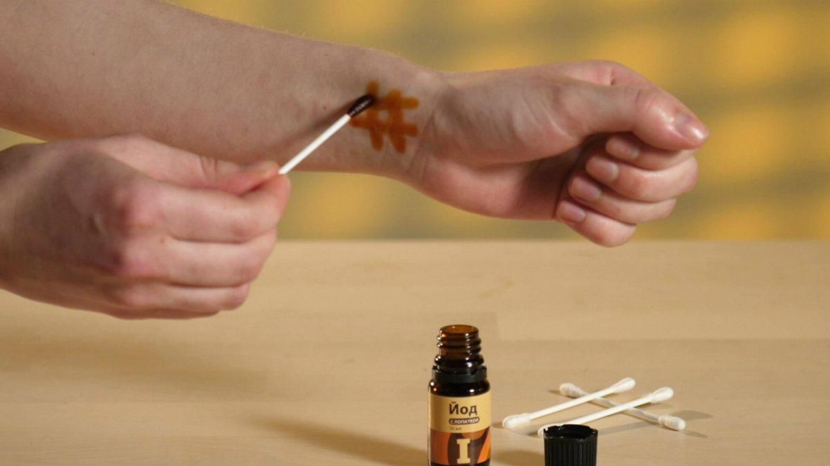 Може нашкодити: у МОЗ спростували застарілий міф про лікування йодною сіткою - Новини Здоров’я Може нашкодити: у МОЗ спростували застарілий міф про лікування йодною сіткою - Новини Здоров’я