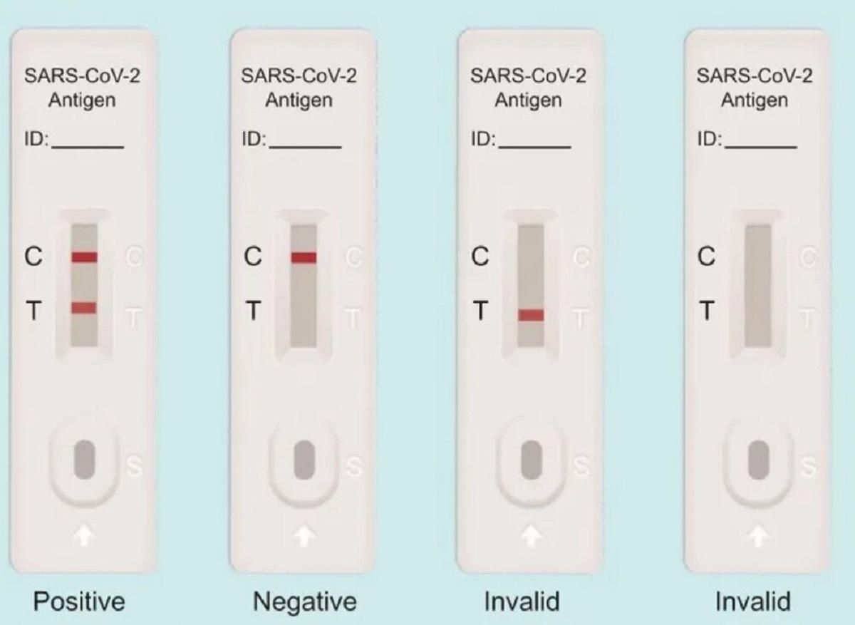 Чего не стоит делать при использовании экспресс-теста на коронавирус Чего не стоит делать при использовании экспресс-теста на коронавирус
