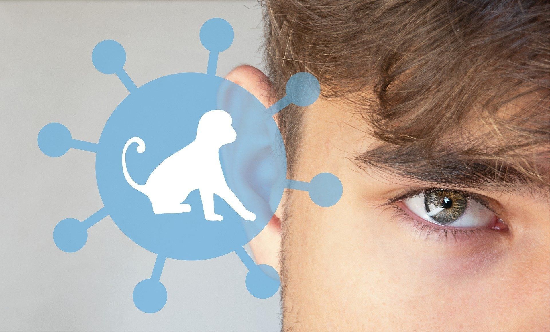 В Украине зарегистрировали второй случай оспы обезьян - все, что известно - Здоровье 24 В Украине зарегистрировали второй случай оспы обезьян - все, что известно - Здоровье 24