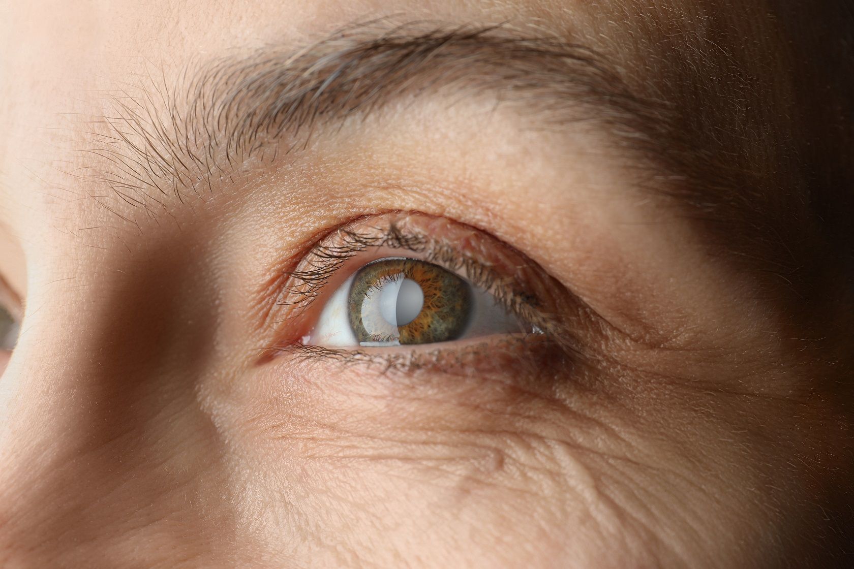 Що таке катаракта, як її виявити та вилікувати