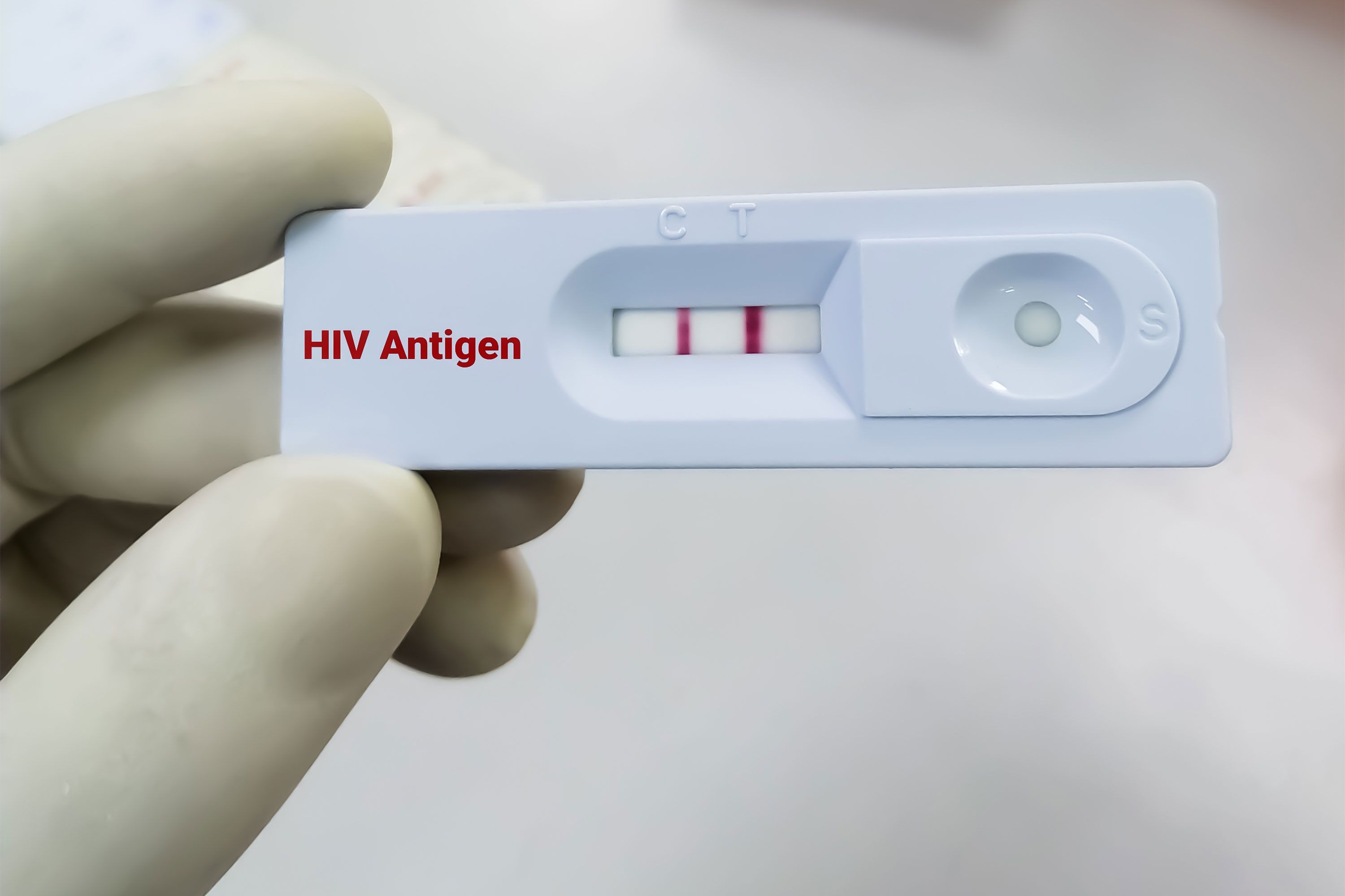 Тест на ВІЛ 