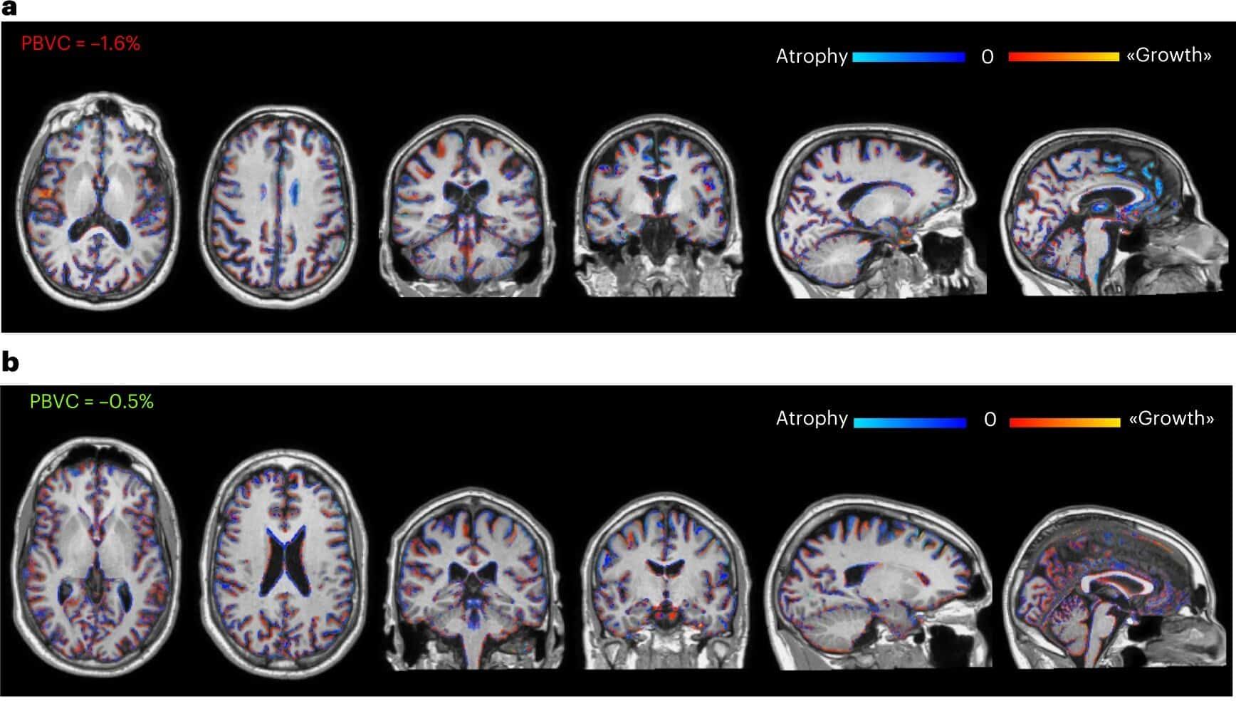 МРТ мозку хврих МРТ мозку хврих