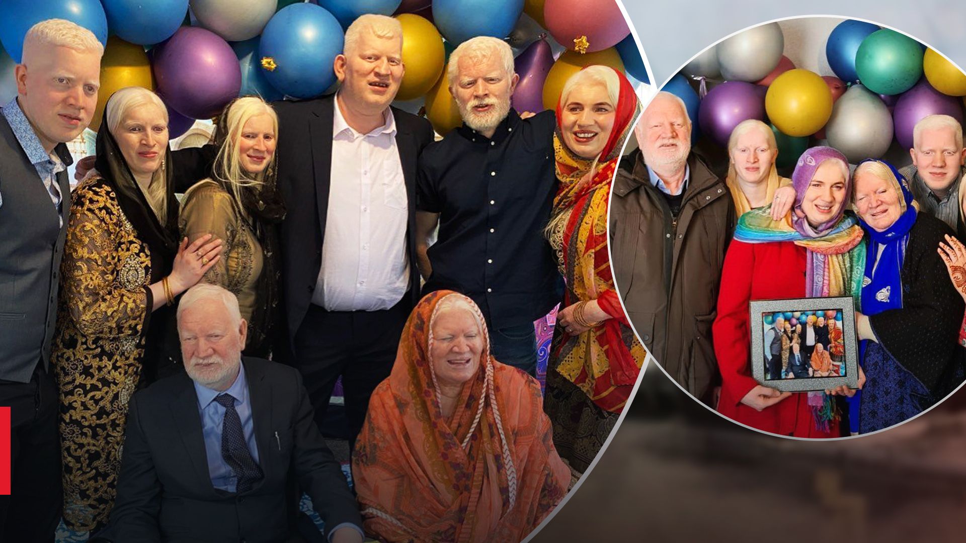 Самая большая семья альбиносов из Великобритании: как они выглядят сейчас - Здоровье 24