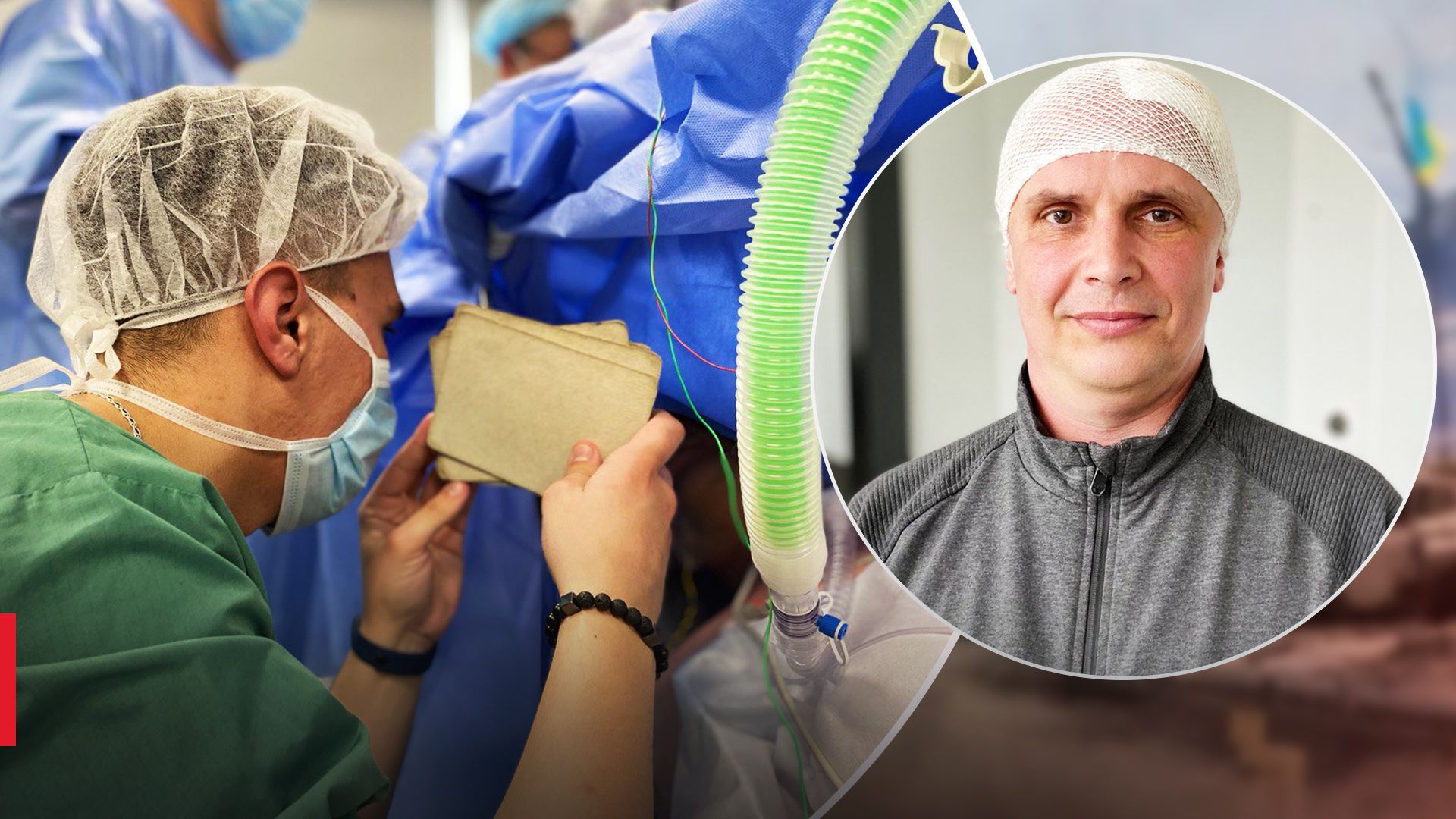 50 минут в сознании при удалении опухоли мозга: во Львове провели уникальную операцию - Здоровье 24