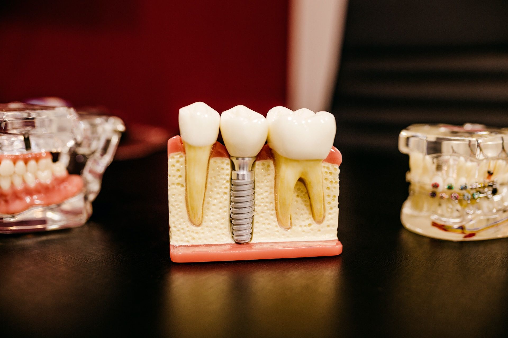 Импланты будут не нужны: разработали препарат для выращивания зубов - Здоровье 24