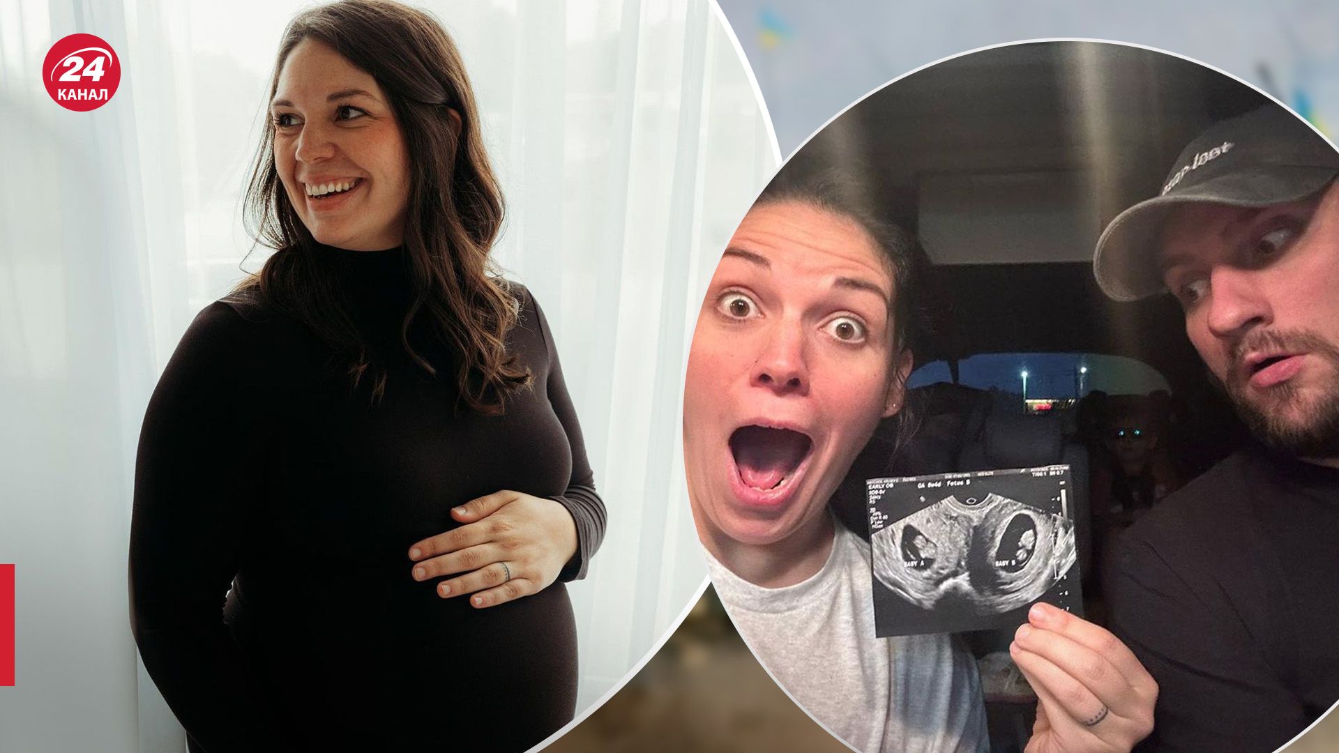 Жінка з двома матками вагітна двійнею