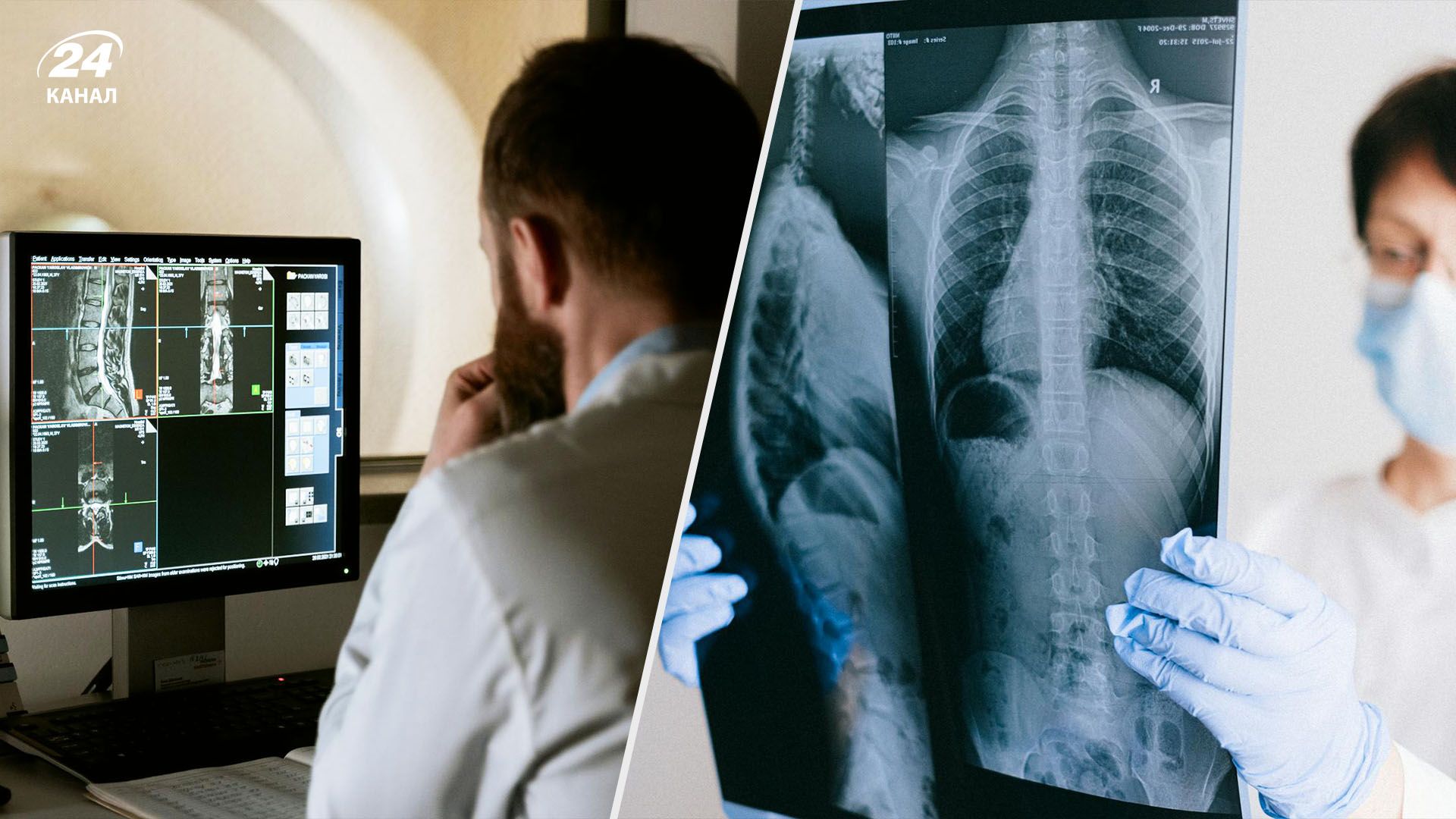 Рентген, КТ чи МРТ: при яких травмах застосовують різні методи діагностики - Здоровʼя 24