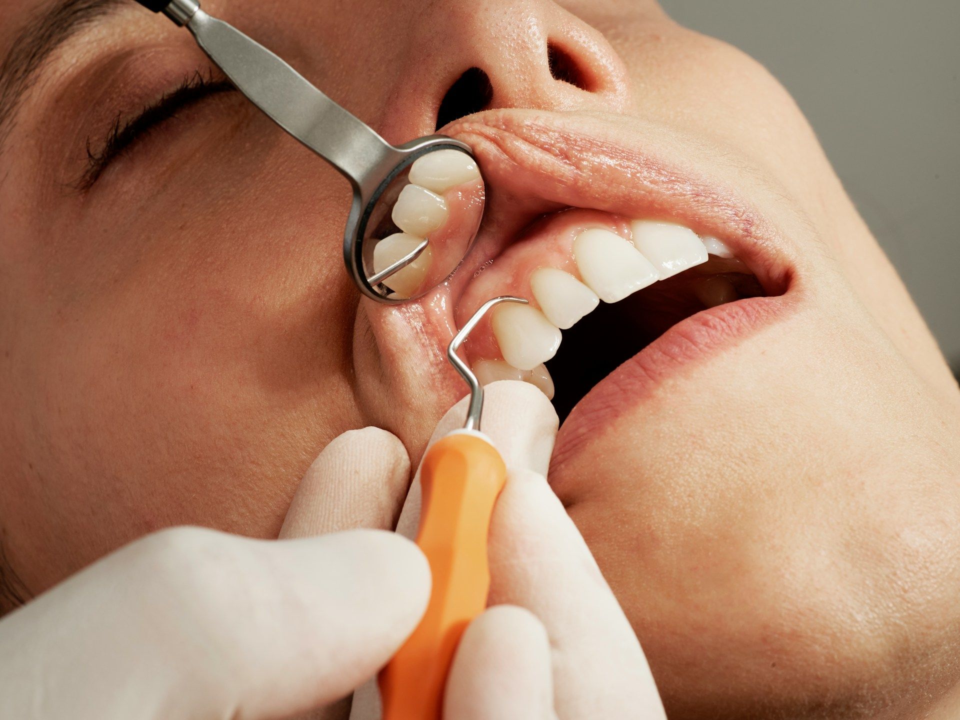 Лікування зубів 