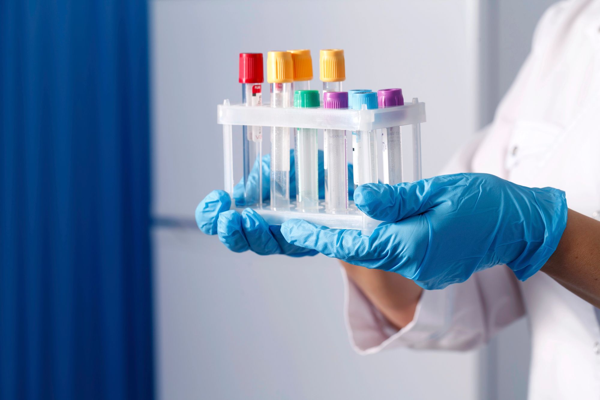 Як підготуватись до аналізів Як підготуватись до аналізів