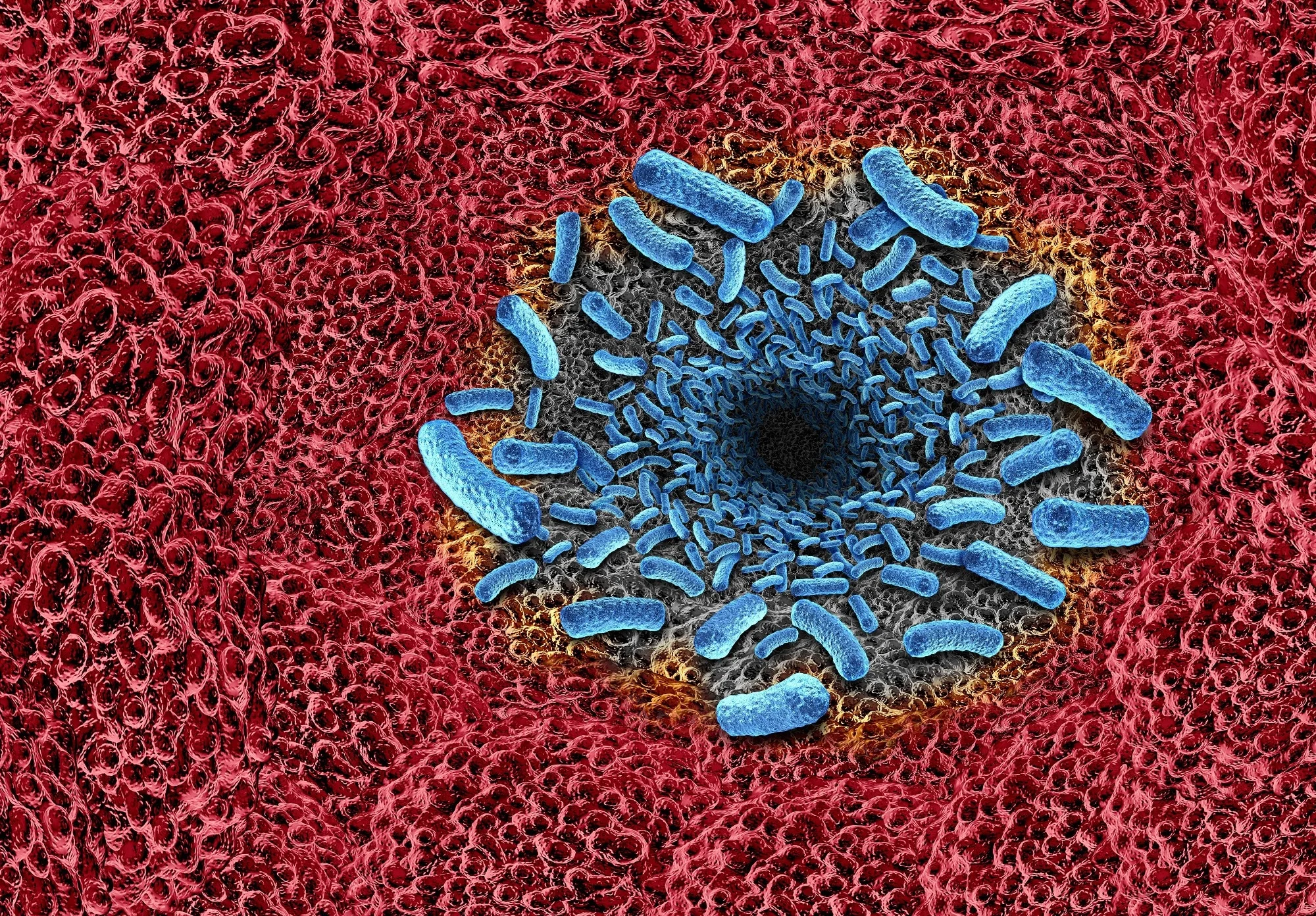 Небезпечна бактерія у прибережних водах США: 26 випадків і п'ять смертей у Луїзіані - Health 24