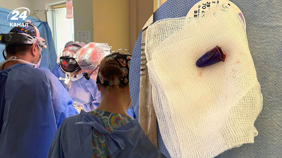 Ковпачок потрапив легені дитини Ковпачок потрапив легені дитини