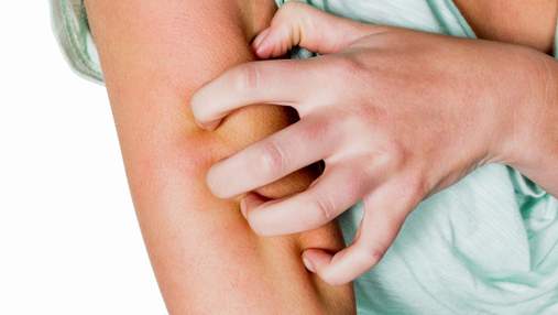 Аллергия на коже: почему возникает, как выглядит и чем лечить
